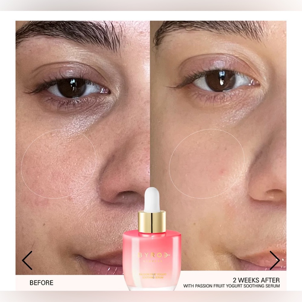 BYROE | Passion Fruit Yogurt Soothing Serum (Brand New!) ✨ - Picture 4 of 16